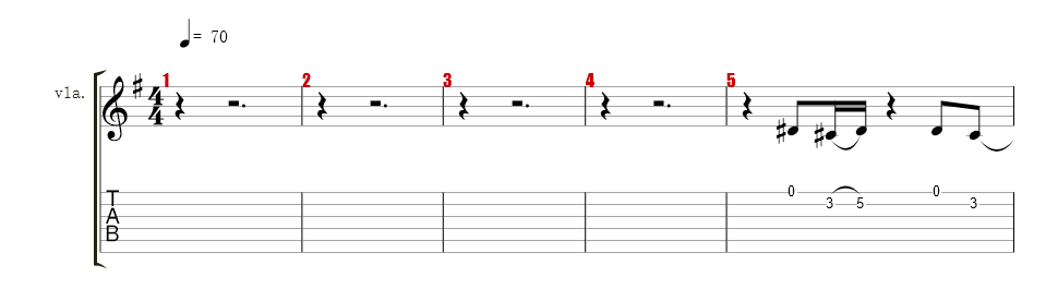 Voice 1
