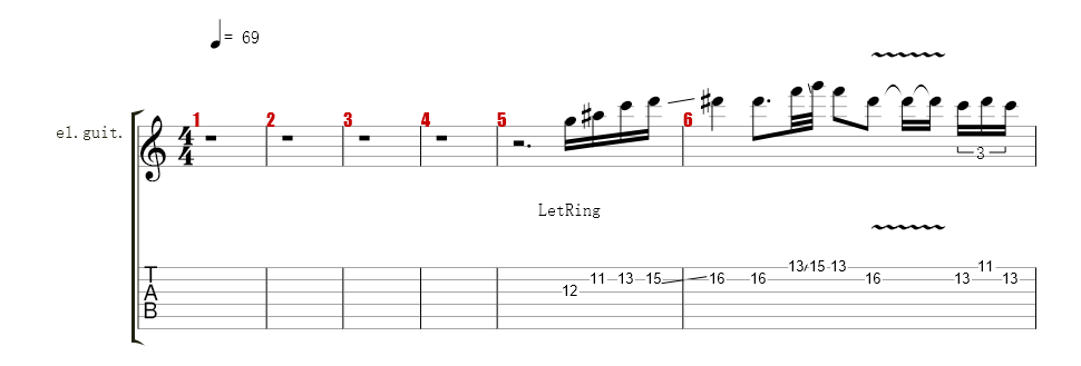电吉他1